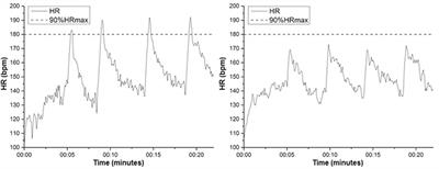 Improvements in Attention and Cardiac Autonomic Modulation After a 2-Weeks Sprint Interval Training Program: A Fidelity Approach